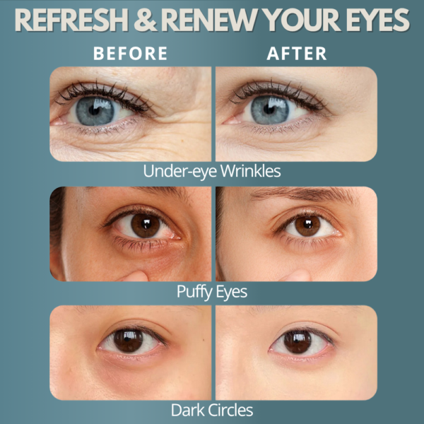 ZEENCARE Under Eye Red Light Therapy Glasses for Dark Circles - Image 2